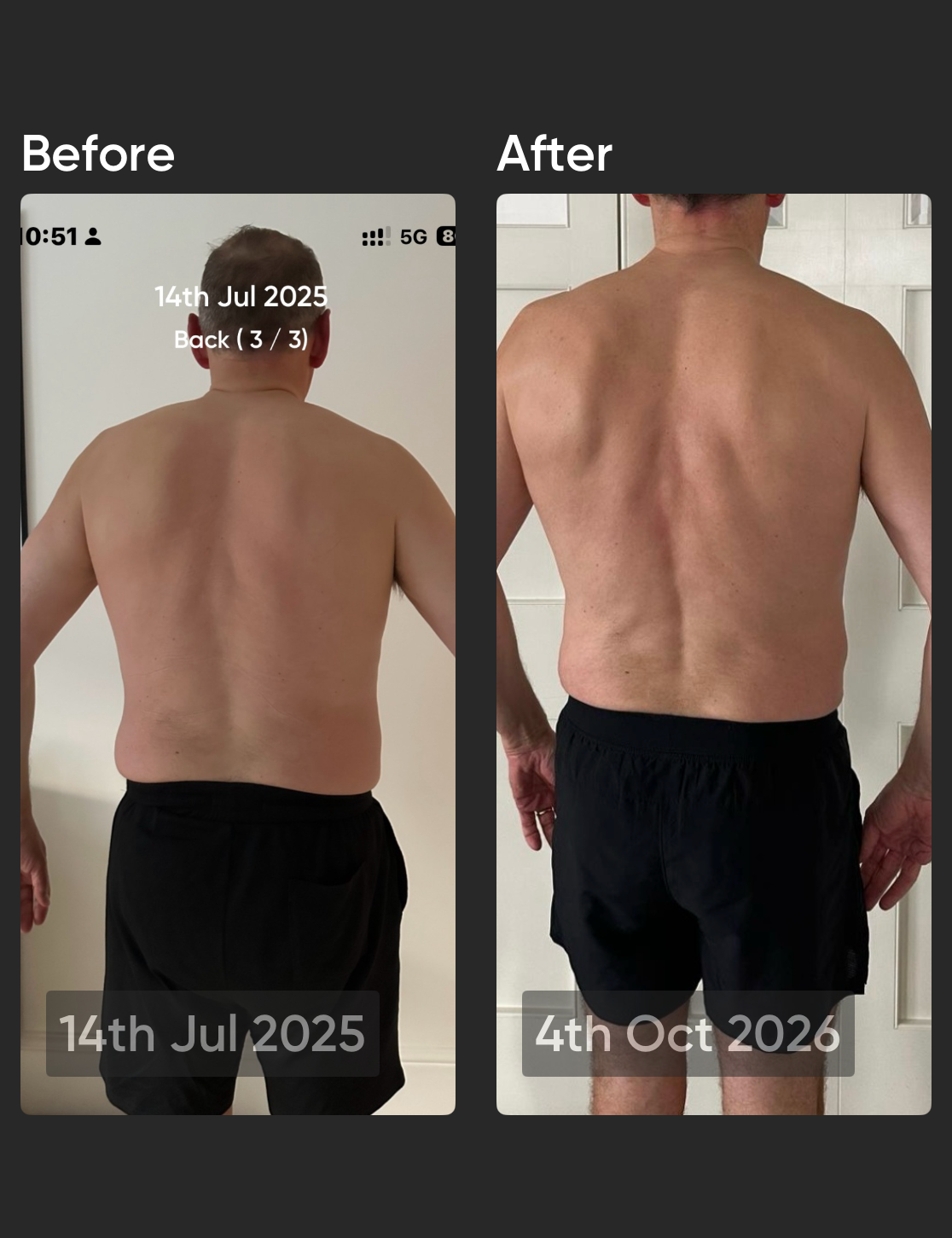 Derek before and after, back view - 14th Jul 2025 to 4th Oct 2026