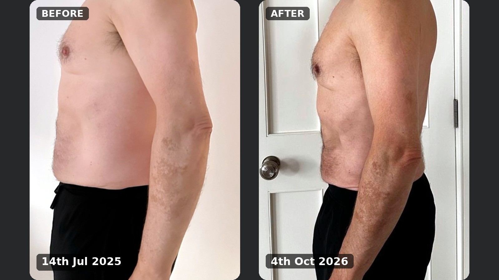 Side view, before and after, 14 July 2025 to 4 October 2026