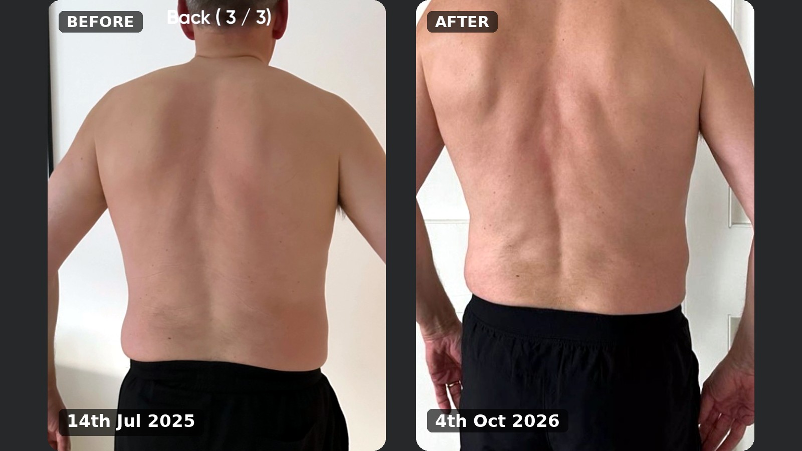 Back view, before and after, 14 July 2025 to 4 October 2026